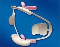 COMFORTVIEW RETRACTOR Universal  2/Pkg. #9061381